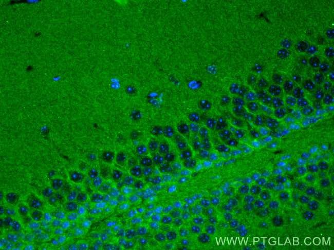 NRCAM Antibody in Immunohistochemistry (PFA fixed) (IHC (PFA))