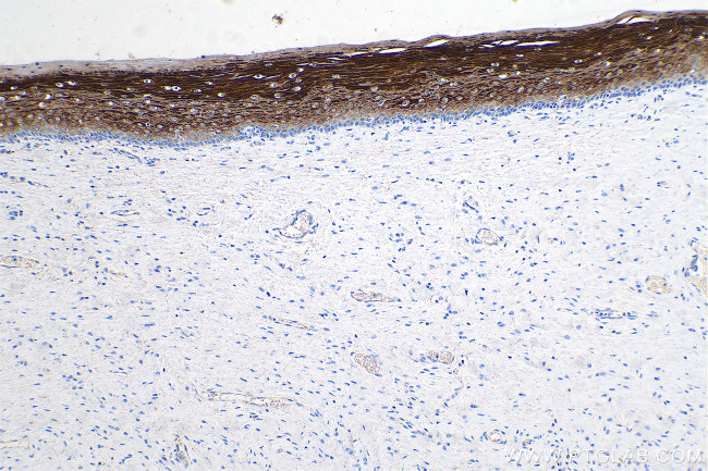 Cytokeratin 6 Antibody in Immunohistochemistry (Paraffin) (IHC (P))