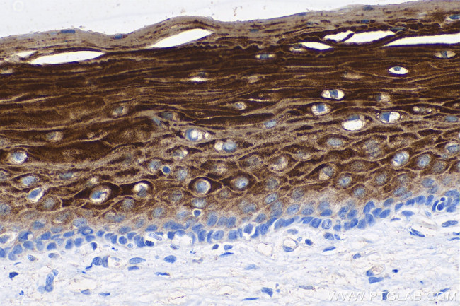 Cytokeratin 6 Antibody in Immunohistochemistry (Paraffin) (IHC (P))