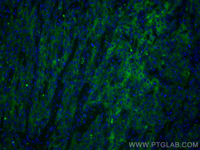 Cytokeratin 5/6 Antibody in Immunohistochemistry (PFA fixed) (IHC (PFA))