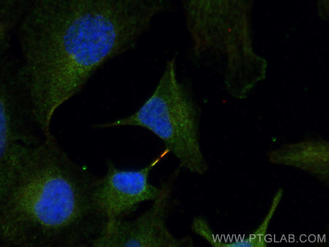 MICAL1 Antibody in Immunocytochemistry (ICC/IF)