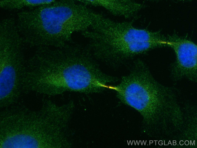 MICAL1 Antibody in Immunocytochemistry (ICC/IF)