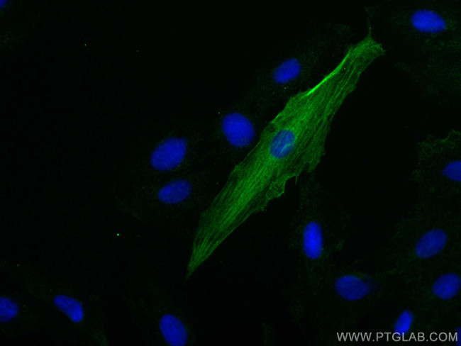 Cardiac Troponin T Antibody in Immunocytochemistry (ICC/IF)