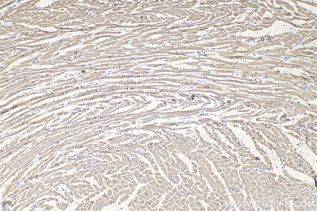 Cardiac Troponin T Antibody in Immunohistochemistry (Paraffin) (IHC (P))