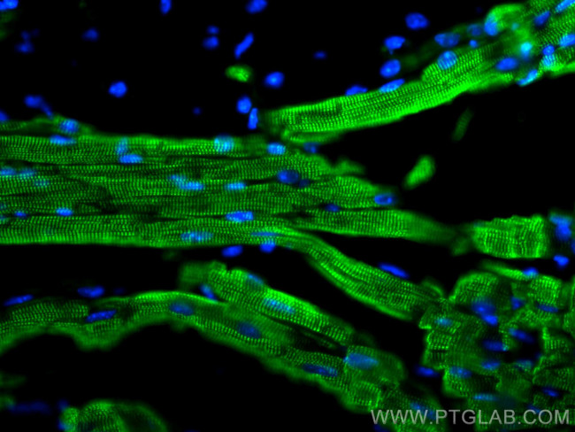 Cardiac Troponin T Antibody in Immunohistochemistry (PFA fixed) (IHC (PFA))