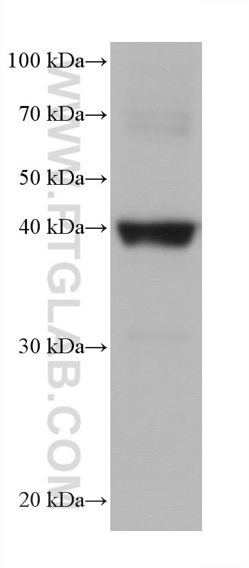 Cardiac Troponin T Antibody in Western Blot (WB)