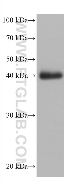 Cardiac Troponin T Antibody in Western Blot (WB)