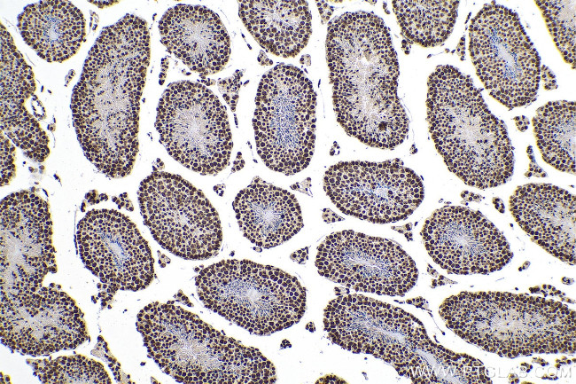 m5C Antibody in Immunohistochemistry (Paraffin) (IHC (P))