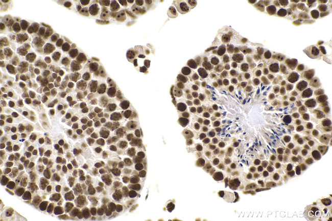 m5C Antibody in Immunohistochemistry (Paraffin) (IHC (P))