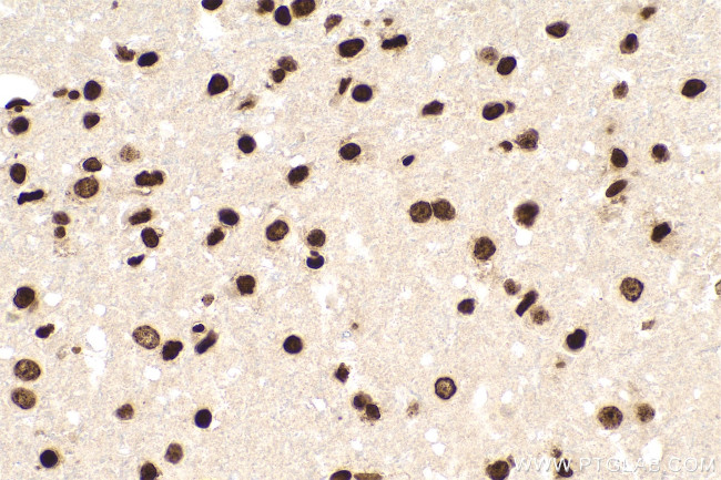 m5C Antibody in Immunohistochemistry (Paraffin) (IHC (P))