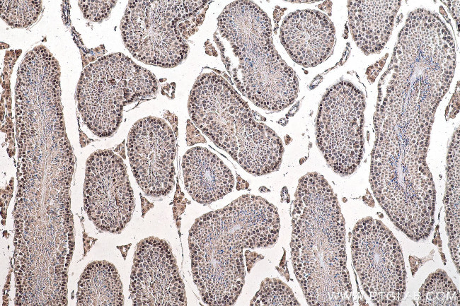 m7G Antibody in Immunohistochemistry (Paraffin) (IHC (P))