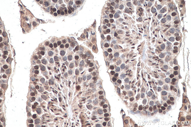 m7G Antibody in Immunohistochemistry (Paraffin) (IHC (P))