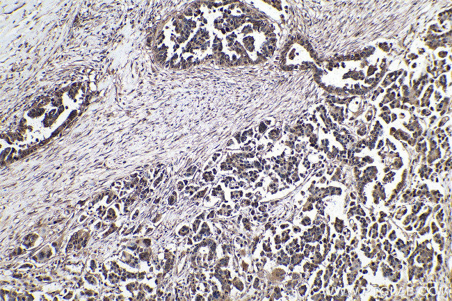 m7G Antibody in Immunohistochemistry (Paraffin) (IHC (P))