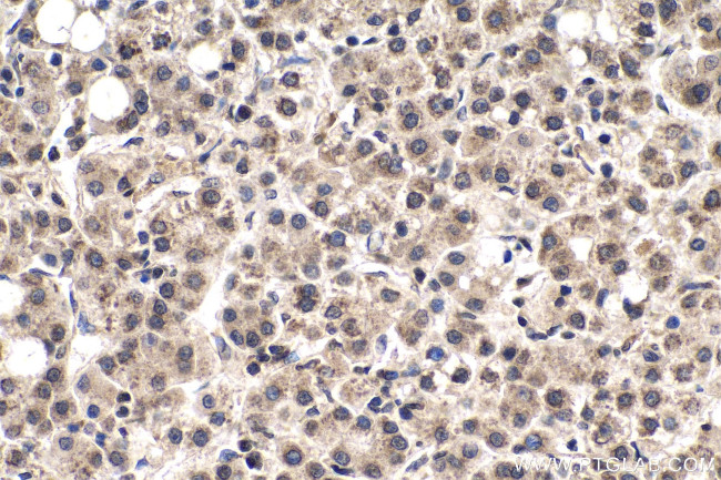 m7G Antibody in Immunohistochemistry (Paraffin) (IHC (P))