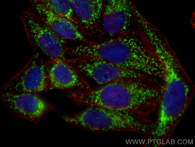 DLAT Antibody in Immunocytochemistry (ICC/IF)