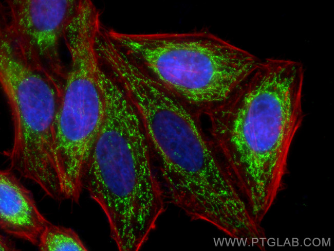 DLAT Antibody in Immunocytochemistry (ICC/IF)