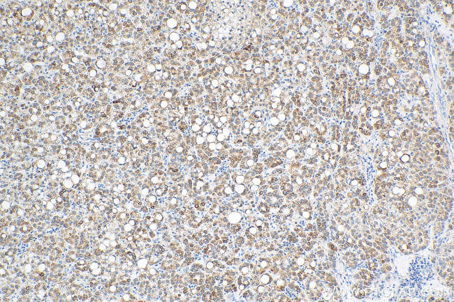 DLAT Antibody in Immunohistochemistry (Paraffin) (IHC (P))