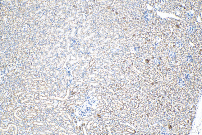 DLAT Antibody in Immunohistochemistry (Paraffin) (IHC (P))