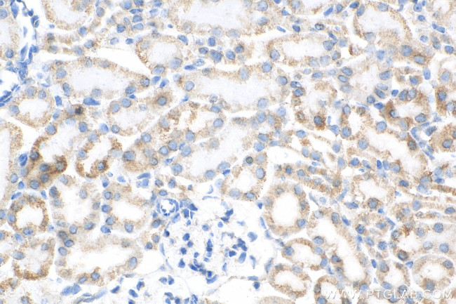 DLAT Antibody in Immunohistochemistry (Paraffin) (IHC (P))