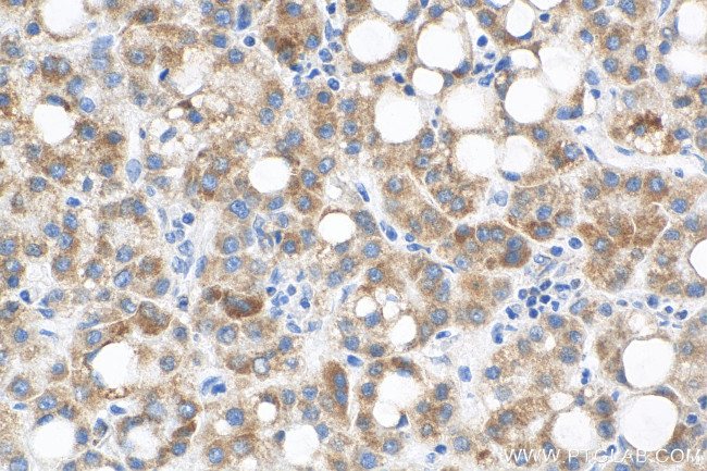 DLAT Antibody in Immunohistochemistry (Paraffin) (IHC (P))