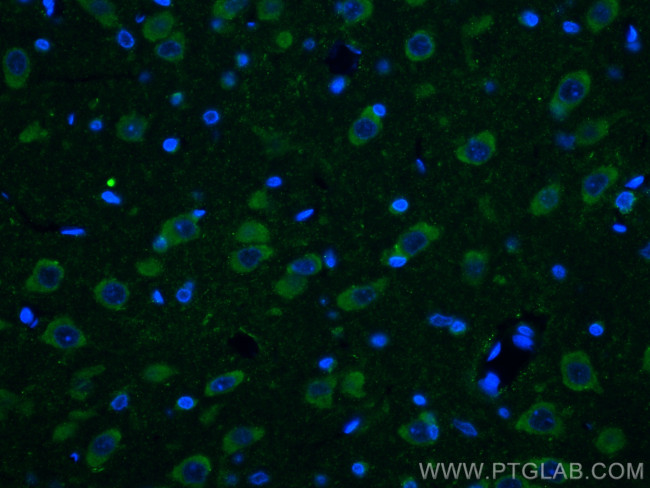 Ataxin 2 Antibody in Immunohistochemistry (PFA fixed) (IHC (PFA))