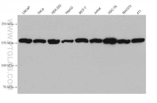 Ataxin 2 Antibody in Western Blot (WB)