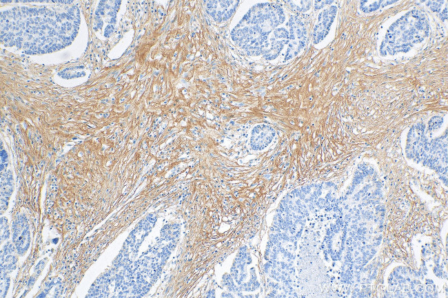 COL3A1 Antibody in Immunohistochemistry (Paraffin) (IHC (P))