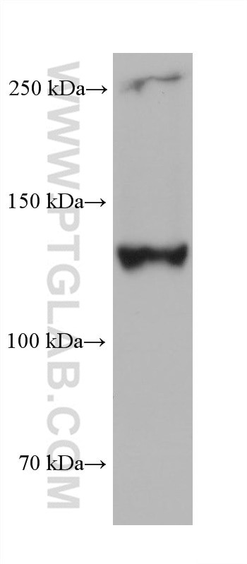 COL3A1 Antibody in Western Blot (WB)