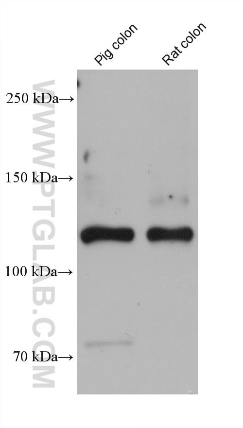 COL3A1 Antibody in Western Blot (WB)