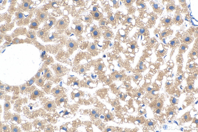 MTHFD1L Antibody in Immunohistochemistry (Paraffin) (IHC (P))