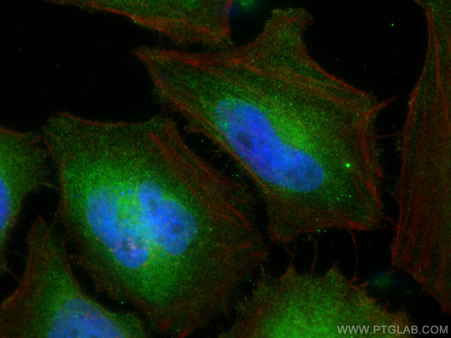 SH3GLB2 Antibody in Immunocytochemistry (ICC/IF)