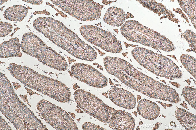 SH3GLB2 Antibody in Immunohistochemistry (Paraffin) (IHC (P))