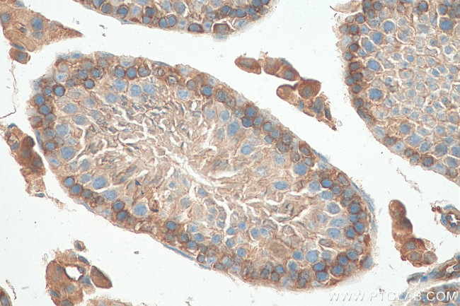 SH3GLB2 Antibody in Immunohistochemistry (Paraffin) (IHC (P))