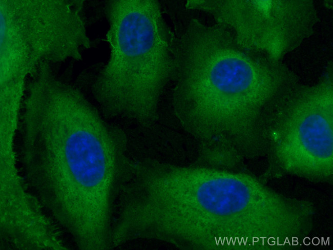 AKR1B10 Antibody in Immunocytochemistry (ICC/IF)