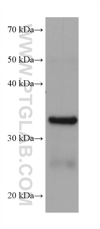 AKR1B10 Antibody in Western Blot (WB)