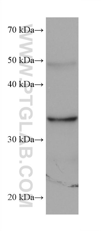 AKR1B10 Antibody in Western Blot (WB)