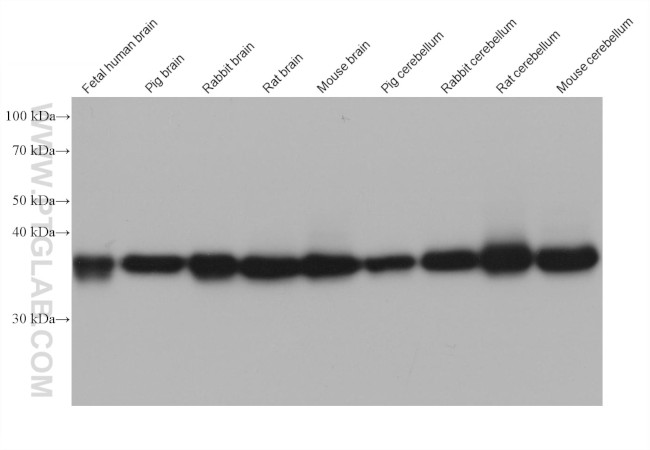 GDAP1L1 Antibody in Western Blot (WB)