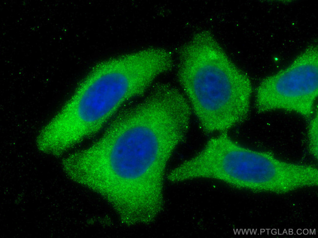 CCS Antibody in Immunocytochemistry (ICC/IF)