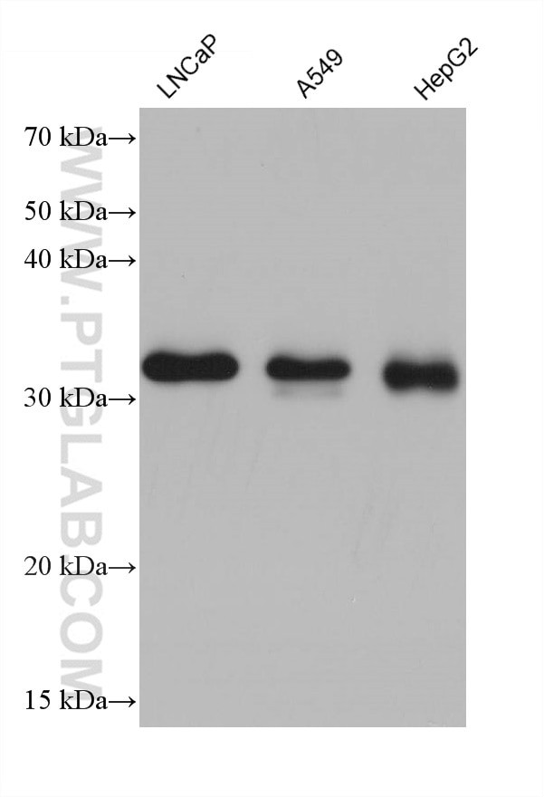 CCS Antibody in Western Blot (WB)