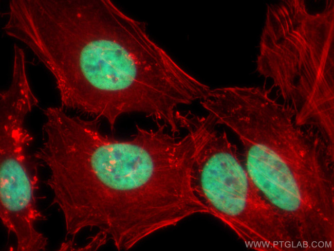 Histone H3 Antibody in Immunocytochemistry (ICC/IF)