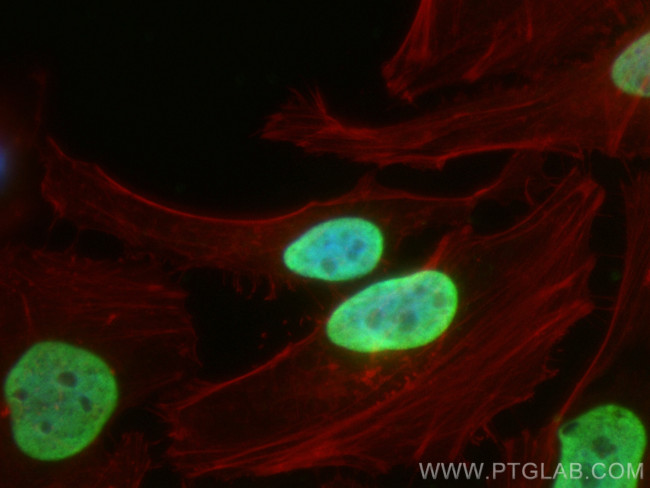 Histone H3 Antibody in Immunocytochemistry (ICC/IF)