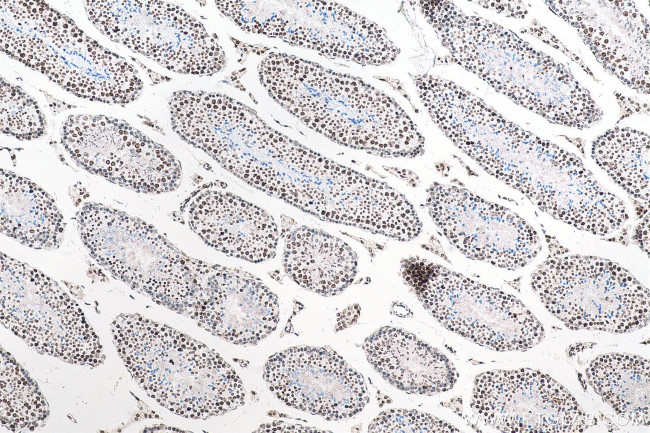 Histone H3 Antibody in Immunohistochemistry (Paraffin) (IHC (P))