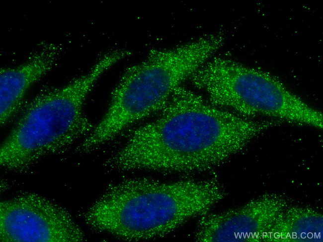 ATPAF2 Antibody in Immunocytochemistry (ICC/IF)