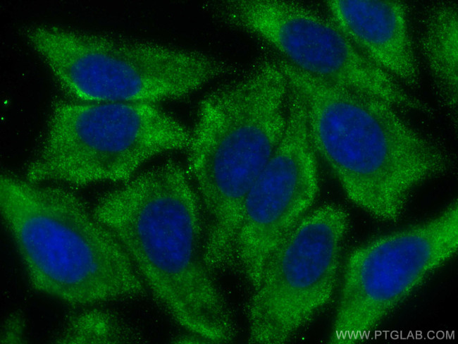 DCTD Antibody in Immunocytochemistry (ICC/IF)