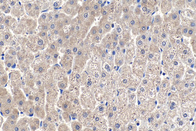 COASY Antibody in Immunohistochemistry (Paraffin) (IHC (P))