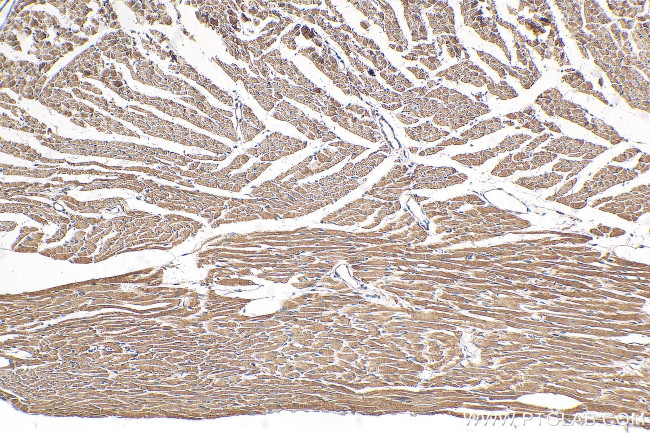 NDUFB7 Antibody in Immunohistochemistry (Paraffin) (IHC (P))