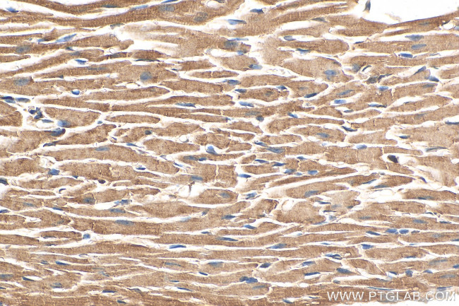 NDUFB7 Antibody in Immunohistochemistry (Paraffin) (IHC (P))