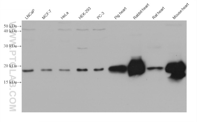 NDUFB7 Antibody in Western Blot (WB)