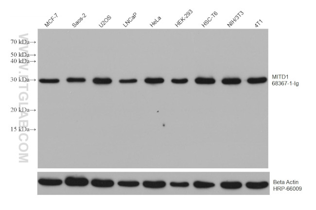 MITD1 Antibody in Western Blot (WB)