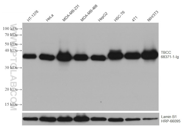 TBCC Antibody in Western Blot (WB)